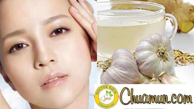 Cách trị mụn trứng cá bằng tỏi cho bạn hiệu quả ngạc nhiên Cách trị mụn trứng cá bằng tỏi cho bạn hiệu quả ngạc nhiên