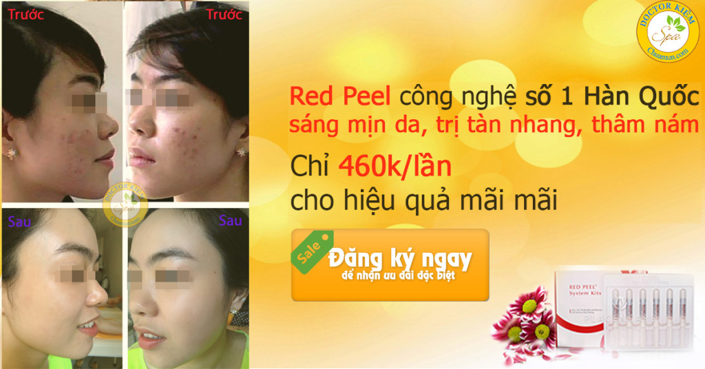 Trị nám da bằng chanh hoàn toàn không mang lại hiệu quả tốt Trị nám da bằng chanh hoàn toàn không mang lại hiệu quả tốt