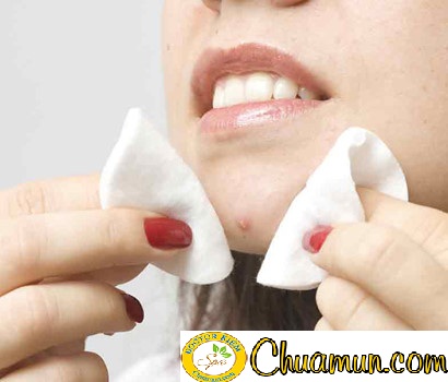 5 điều tối kỵ khi điều trị mụn bạn cần phải biết 5 điều tối kỵ khi điều trị mụn bạn cần phải biết
