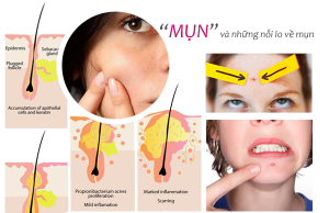 mun-o-tuoi-day-thi