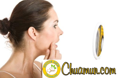 Làm thế nào để trị mụn trứng cá nhanh nhất?